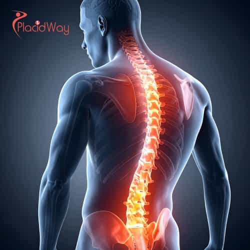 Stem Cell Therapy for SMA in India: Guide for Patients